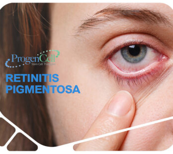 Retinitis pigmentosa y células madre
