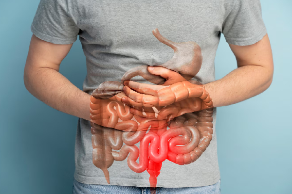 ¿Cuáles son los sintomas de la enfermedad de Crohn?
