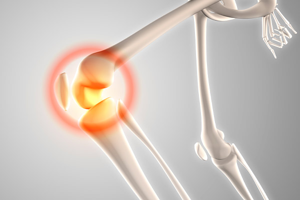 ¿Qué es el ligamento colateral medial?.