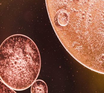 Cuidados posteriores al tratamiento con Células madre