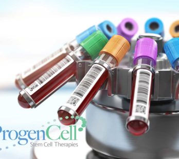 What is the difference between PRP and Stem Cell Therapy
