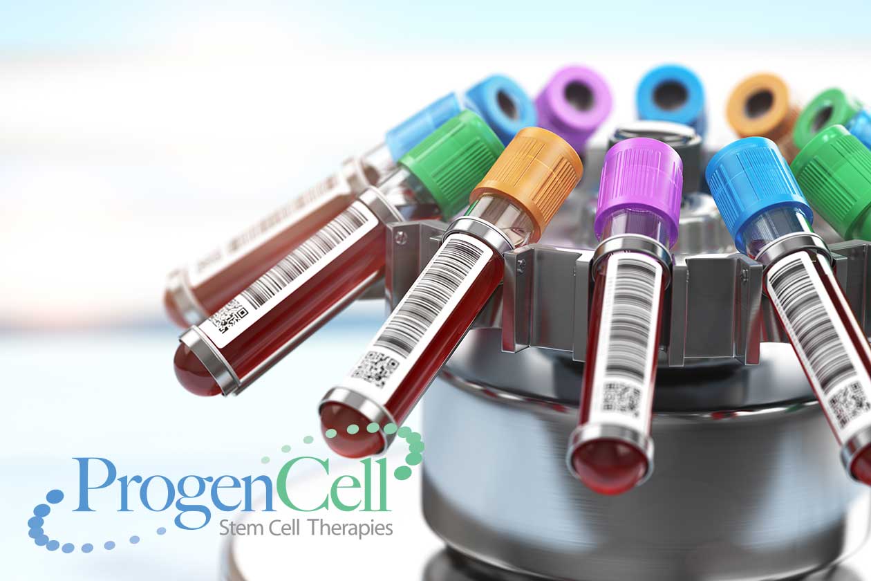 What is the difference between PRP and Stem Cell Therapy