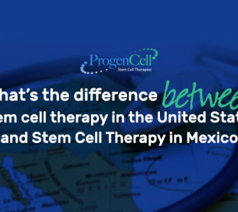 What is the difference between stem cell therapy in the United States and Stem Cell Therapy in Mexico