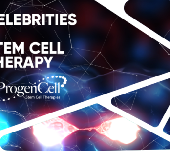 Celebrities and Stem Cell Therapy