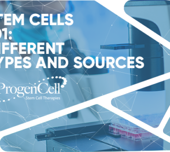 Different types of stem cell therapy