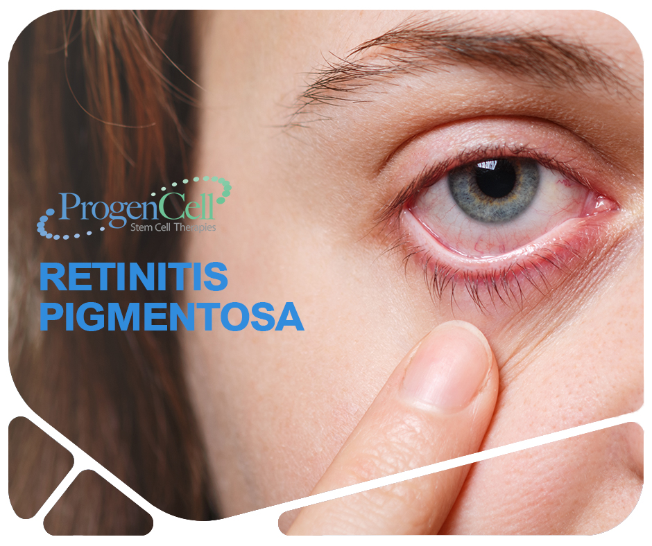 people with retinitis pigmentosa