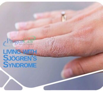Living with sjogrens syndrome