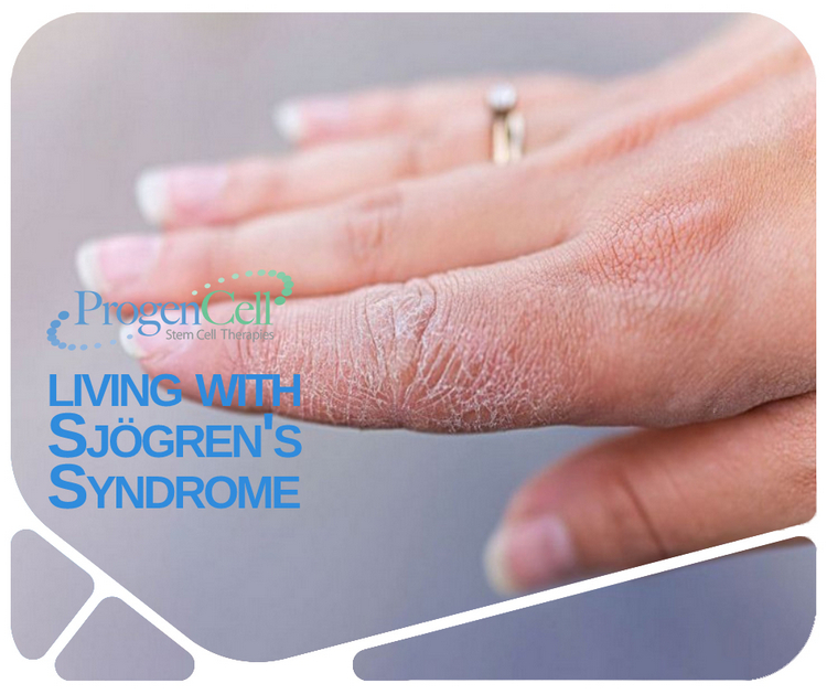 Living with sjogrens syndrome