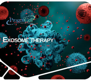 Exosome therapy ProgenCell