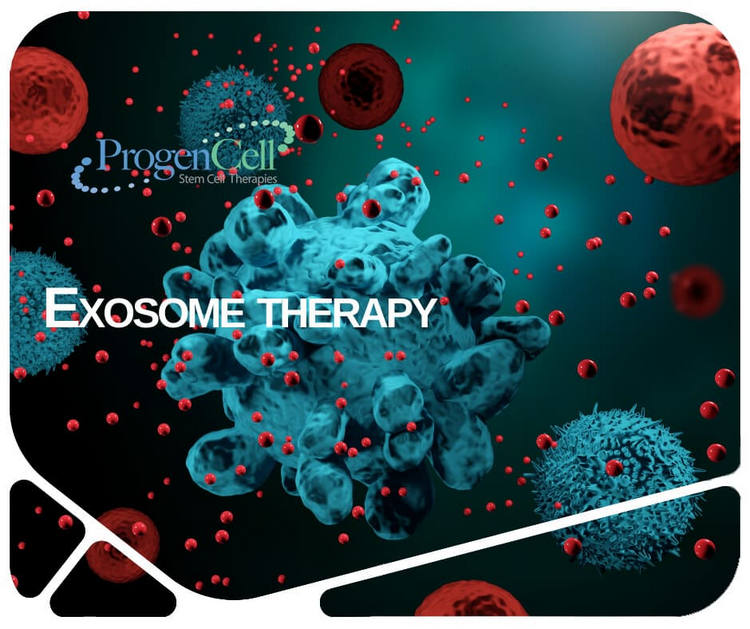 Exosome therapy ProgenCell