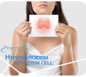 Hypothyroidims treatment with stem cells