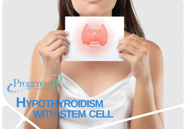 Hypothyroidims treatment with stem cells