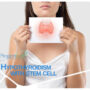 Hypothyroidims treatment with stem cells