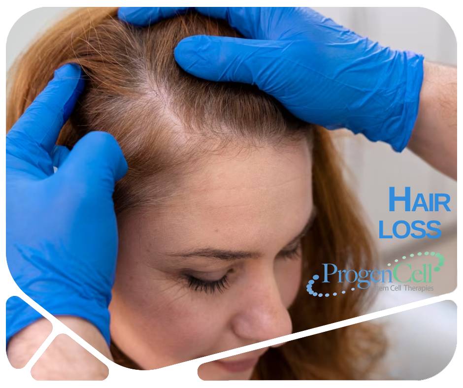 The Latest Research For Stem Cell Application For Hair Loss 9424