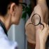 How to Treat Scleroderma